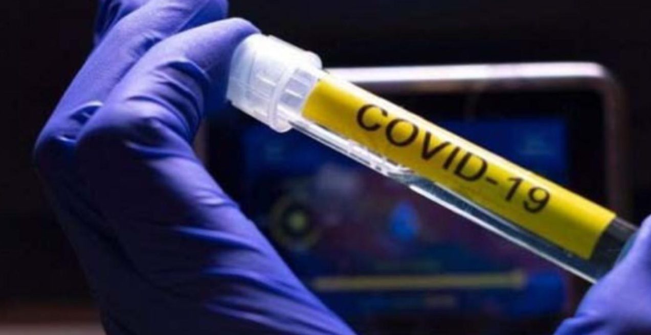 Región de Antofagasta sumó 88 nuevos casos de Covid-19 en las últimas 24 horas